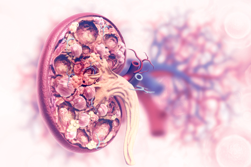 Lupus Nephritis